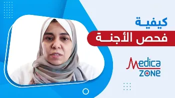 الأوقات المثالية لعمل فحص الأجنة في أثناء الحمل