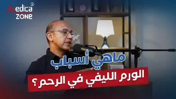 اسباب الاورام الليفية الرحمية