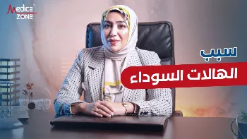 تعرف على سبب الهالات السوداء تحت العين وكيفية علاجها