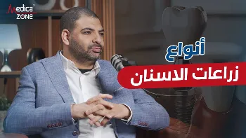 ما هي أنواع زرعات الأسنان في مصر؟