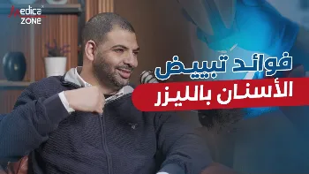 ما أفضل تقنيات تبييض الأسنان؟ إليك الإجابة 