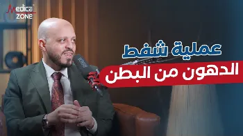أهم ما يجب معرفته عن عملية شفط الدهون من البطن